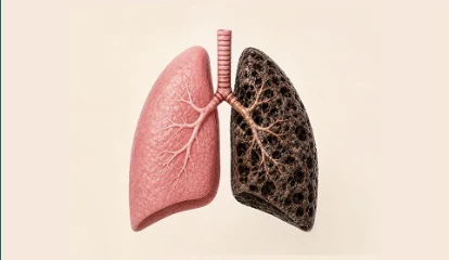 Asthma and COPD Management Plans